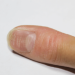 爪にスジが入っている