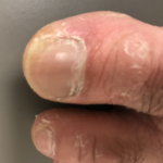 10年近く放置している