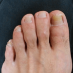 薬を飲み続けるのが苦痛で放置