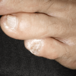 20年ほど前に病院で診察を受けた