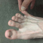 治療開始から2週間ほど経過