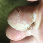 病院で25年治療している